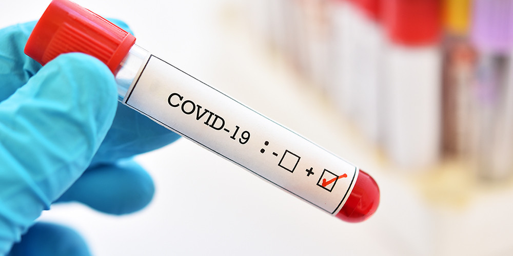 गुर्जो उपयोगी, आयुर्वेदिक औषधिको माग बढ्दो