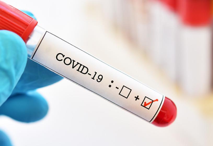 गुर्जो उपयोगी, आयुर्वेदिक औषधिको माग बढ्दो