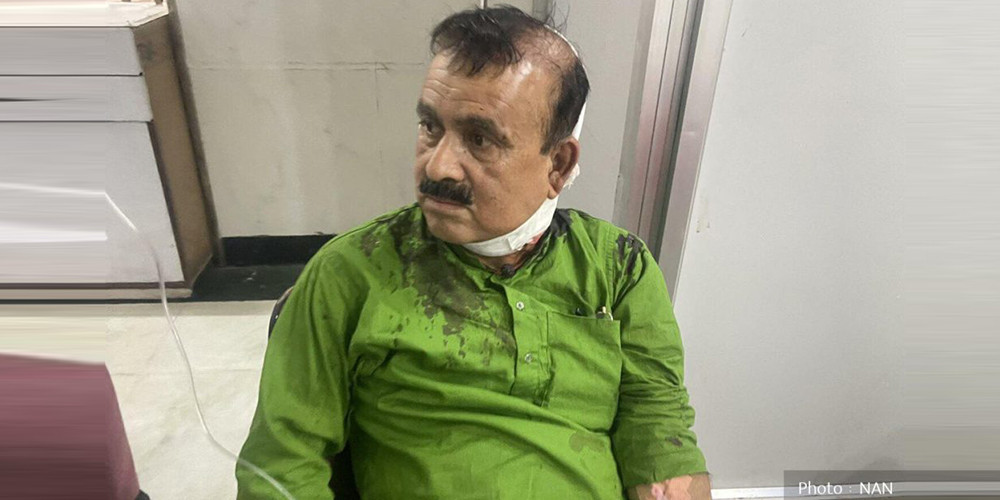 कांग्रेसका सहमहामन्त्री यादव साङ्घातिक आक्रमणबाट घाइते, कांग्रेसद्वारा निन्दा