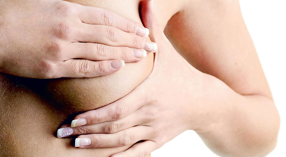 के हो स्तनबाट दूध बग्ने समस्या ? यसो भन्छन् डाक्टर