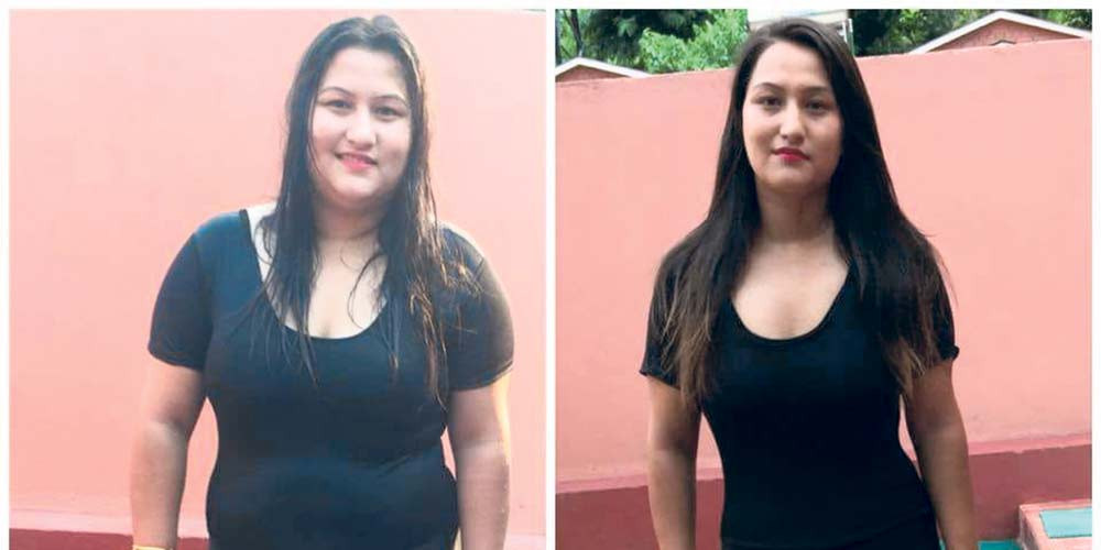 ‘सुजनाले घरमै घटाइन् ६ महिनामा ३६ केजी’