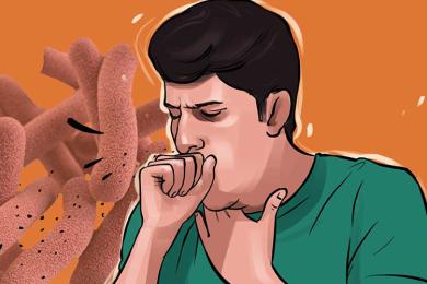 बागलुङका एउटै पालिकामा १११ क्षयरोगी